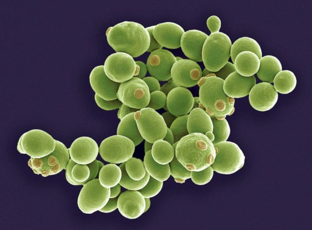 在显微镜的酵母 库存图片. 图片 包括有 传染, 健康, 放大, 贝蒂, 实验室, 医疗, 叫化子, 背包 - 111147603